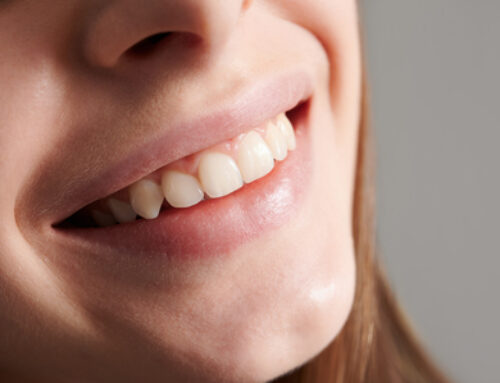 Teeth Whitening treatment… What is it?